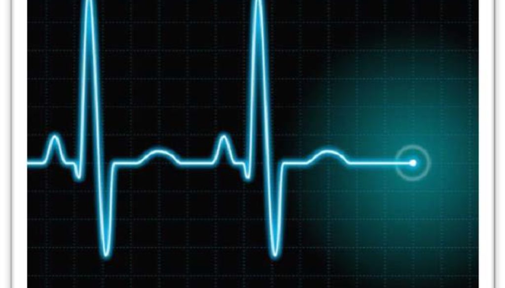 Defibrilator heart heartbeat