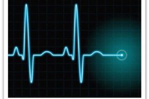 Defibrilator heart heartbeat